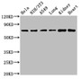 Western Blot; Positive WB detected in: Hela whole cell lysate, NIH/3T3 whole cell lysate, A549 whole cell lysate, Rat lung tissue, Rat kidney tissue, Mouse heart tissue; All lanes: ARHGAP18 antibody at 4.5µg/ml; Secondary; Goat polyclonal to rabbit IgG at 1/50000 dilution; Predicted band size: 75, 71 kDa; Observed band size: 75 kDa Western Blot; Positive WB detected in: Hela whole cell lysate, NIH/3T3 whole cell lysate, A549 whole cell lysate, Rat lung tissue, Rat kidney tissue, Mouse heart tissue; All lanes: ARHGAP18 antibody at 4.5µg/ml; Secondary; Goat polyclonal to rabbit IgG at 1/50000 dilution; Predicted band size: 75, 71 kDa; Observed band size: 75 kDa
