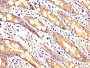 IHC image diluted at 1:200 and staining in paraffin-embedded human small intestine tissue performed on a Leica BondTM system. After dewaxing and hydration, antigen retrieval was mediated by high pressure in a citrate buffer (pH 6.0). Section was blocked with 10% normal goat serum 30min at RT. Then primary antibody (1% BSA) was incubated at 4°C overnight. The primary is detected by a biotinylated secondary antibody and visualized using an HRP conjugated SP system. IHC image diluted at 1:200 and staining in paraffin-embedded human small intestine tissue performed on a Leica BondTM system. After dewaxing and hydration, antigen retrieval was mediated by high pressure in a citrate buffer (pH 6.0). Section was blocked with 10% normal goat serum 30min at RT. Then primary antibody (1% BSA) was incubated at 4°C overnight. The primary is detected by a biotinylated secondary antibody and visualized using an HRP conjugated SP system.