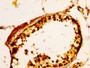 IHC image of CAC11270 diluted at 1:100 and staining in paraffin-embedded human testis tissue performed on a Leica BondTM system. After dewaxing and hydration, antigen retrieval was mediated by high pressure in a citrate buffer (pH 6.0). Section was blocked with 10% normal goat serum 30min at RT. Then primary antibody (1% BSA) was incubated at 4°C overnight. The primary is detected by a biotinylated secondary antibody and visualized using an HRP conjugated SP system. IHC image of CAC11270 diluted at 1:100 and staining in paraffin-embedded human testis tissue performed on a Leica BondTM system. After dewaxing and hydration, antigen retrieval was mediated by high pressure in a citrate buffer (pH 6.0). Section was blocked with 10% normal goat serum 30min at RT. Then primary antibody (1% BSA) was incubated at 4°C overnight. The primary is detected by a biotinylated secondary antibody and visualized using an HRP conjugated SP system.