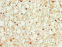 IHC image diluted at 1:100 and staining in paraffin-embedded human brain tissue performed on a Leica BondTM system. After dewaxing and hydration, antigen retrieval was mediated by high pressure in a citrate buffer (pH 6.0). Section was blocked with 10% normal goat serum 30min at RT. Then primary antibody (1% BSA) was incubated at 4°C overnight. The primary is detected by a biotinylated secondary antibody and visualized using an HRP conjugated SP system. IHC image diluted at 1:100 and staining in paraffin-embedded human brain tissue performed on a Leica BondTM system. After dewaxing and hydration, antigen retrieval was mediated by high pressure in a citrate buffer (pH 6.0). Section was blocked with 10% normal goat serum 30min at RT. Then primary antibody (1% BSA) was incubated at 4°C overnight. The primary is detected by a biotinylated secondary antibody and visualized using an HRP conjugated SP system.