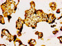 IHC image diluted at 1:500 and staining in paraffin-embedded human placenta tissue performed on a Leica BondTM system. After dewaxing and hydration, antigen retrieval was mediated by high pressure in a citrate buffer (pH 6.0). Section was blocked with 10% normal goat serum 30min at RT. Then primary antibody (1% BSA) was incubated at 4°C overnight. The primary is detected by a biotinylated secondary antibody and visualized using an HRP conjugated SP system. IHC image diluted at 1:500 and staining in paraffin-embedded human placenta tissue performed on a Leica BondTM system. After dewaxing and hydration, antigen retrieval was mediated by high pressure in a citrate buffer (pH 6.0). Section was blocked with 10% normal goat serum 30min at RT. Then primary antibody (1% BSA) was incubated at 4°C overnight. The primary is detected by a biotinylated secondary antibody and visualized using an HRP conjugated SP system.