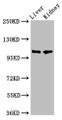 Western Blot; Positive WB detected in: Rat liver tissue, Mouse kidney tissue; All lanes: PEAR1 antibody at 5.2µg/ml; Secondary; Goat polyclonal to rabbit IgG at 1/50000 dilution; Predicted band size: 111 kDa; Observed band size: 111 kDa; Western Blot; Positive WB detected in: Rat liver tissue, Mouse kidney tissue; All lanes: PEAR1 antibody at 5.2µg/ml; Secondary; Goat polyclonal to rabbit IgG at 1/50000 dilution; Predicted band size: 111 kDa; Observed band size: 111 kDa;