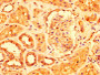 IHC image diluted at 1:500 and staining in paraffin-embedded human kidney tissue performed on a Leica BondTM system. After dewaxing and hydration, antigen retrieval was mediated by high pressure in a citrate buffer (pH 6.0). Section was blocked with 10% normal goat serum 30min at RT. Then primary antibody (1% BSA) was incubated at 4°C overnight. The primary is detected by a biotinylated secondary antibody and visualized using an HRP conjugated SP system.