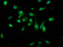 Immunofluorescence staining of U251 cells with CAC11282 at 1:166, counter-stained with DAPI. The cells were fixed in 4% formaldehyde, permeabilized using 0.2% Triton X-100 and blocked in 10% normal Goat Serum. The cells were then incubated with the antibody overnight at 4°C. The secondary antibody was Alexa Fluor 488-congugated AffiniPure Goat Anti-Rabbit IgG(H+L).