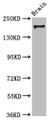 Western Blot; Positive WB detected in: Mouse brain tissue; All lanes: MYO5A antibody at 7.3µg/ml; Secondary; Goat polyclonal to rabbit IgG at 1/50000 dilution; Predicted band size: 216, 213, 219 kDa; Observed band size: 216 kDa;