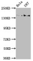 Western Blot; , Positive WB detected in: Hela whole cell lysate, U87 whole cell lysate; , All lanes: MYO5A antibody at 1:2000; , Secondary; , Goat polyclonal to rabbit IgG at 1/50000 dilution; , Predicted band size: 216, 213, 219 kDa; , Observed band size: 216 kDa;