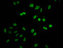 Immunofluorescent analysis of Hela cells using CAC11301 at dilution of 1:100 and Alexa Fluor 488-congugated AffiniPure Goat Anti-Rabbit IgG(H+L)