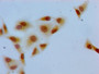 Immunocytochemistry analysis of Hela cells using CAC11302 at dilution of 1:100