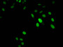 Immunofluorescent analysis of Hela cells using CAC11303 at dilution of 1:100 and Alexa Fluor 488-congugated AffiniPure Goat Anti-Rabbit IgG(H+L)