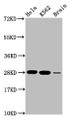Western Blot; Positive WB detected in: Hela whole cell lysate, K562 whole cell lysate, Rat brain tissue; All lanes: HIST1H1E antibody at 1.48µg/ml; Secondary; Goat polyclonal to rabbit IgG at 1/50000 dilution; Predicted band size: 22 kDa; Observed band size: 28 kDa