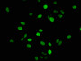 Immunofluorescence staining of Hela cells with CAC11304 at 1:2.5, counter-stained with DAPI. The cells were fixed in 4% formaldehyde, permeabilized using 0.2% Triton X-100 and blocked in 10% normal Goat Serum. The cells were then incubated with the antibody overnight at 4°C. The secondary antibody was Alexa Fluor 488-congugated AffiniPure Goat Anti-Rabbit IgG(H+L).
