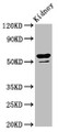 Western Blot; Positive WB detected in: Rat kidney tissue; All lanes: CYP8B1 antibody at 6.4µg/ml; Secondary; Goat polyclonal to rabbit IgG at 1/50000 dilution; Predicted band size: 59 kDa; Observed band size: 59 kDa;