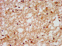 IHC image of CAC11310 diluted at 1:400 and staining in paraffin-embedded human brain tissue performed on a Leica BondTM system. After dewaxing and hydration, antigen retrieval was mediated by high pressure in a citrate buffer (pH 6.0). Section was blocked with 10% normal goat serum 30min at RT. Then primary antibody (1% BSA) was incubated at 4°C overnight. The primary is detected by a biotinylated secondary antibody and visualized using an HRP conjugated SP system.