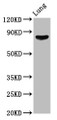Western Blot; Positive WB detected in: Rat lung tissue; All lanes: ITGB6 antibody at 6.12µg/ml; Secondary; Goat polyclonal to rabbit IgG at 1/50000 dilution; Predicted band size: 86, 75 kDa; Observed band size: 86 kDa;