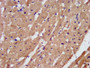IHC image diluted at 1:200 and staining in paraffin-embedded human heart tissue performed on a Leica BondTM system. After dewaxing and hydration, antigen retrieval was mediated by high pressure in a citrate buffer (pH 6.0). Section was blocked with 10% normal goat serum 30min at RT. Then primary antibody (1% BSA) was incubated at 4°C overnight. The primary is detected by a biotinylated secondary antibody and visualized using an HRP conjugated SP system.