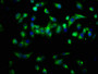 Immunofluorescence staining of Hela cells with CAC11315 at 1:66, counter-stained with DAPI. The cells were fixed in 4% formaldehyde, permeabilized using 0.2% Triton X-100 and blocked in 10% normal Goat Serum. The cells were then incubated with the antibody overnight at 4°C. The secondary antibody was Alexa Fluor 488-congugated AffiniPure Goat Anti-Rabbit IgG(H+L).