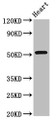 Western Blot; Positive WB detected in: Rat heart tissue; All lanes: RGS6 antibody at 8µg/ml; Secondary; Goat polyclonal to rabbit IgG at 1/50000 dilution; Predicted band size: 55, 57, 54, 50, 51, 53, 52, 41, 56 kDa; Observed band size: 55 kDa;