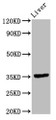 Western Blot; Positive WB detected in: Rat liver tissue; All lanes: EPCAM antibody at 9.6µg/ml; Secondary; Goat polyclonal to rabbit IgG at 1/50000 dilution; Predicted band size: 35 kDa; Observed band size: 35 kDa;