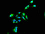 Immunofluorescence staining of Hela cells with CAC11325 at 1:100, counter-stained with DAPI. The cells were fixed in 4% formaldehyde, permeabilized using 0.2% Triton X-100 and blocked in 10% normal Goat Serum. The cells were then incubated with the antibody overnight at 4°C. The secondary antibody was Alexa Fluor 488-congugated AffiniPure Goat Anti-Rabbit IgG(H+L).