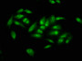 Immunofluorescence staining of Hela cells with CAC11327 at 1:66, counter-stained with DAPI. The cells were fixed in 4% formaldehyde, permeabilized using 0.2% Triton X-100 and blocked in 10% normal Goat Serum. The cells were then incubated with the antibody overnight at 4°C. The secondary antibody was Alexa Fluor 488-congugated AffiniPure Goat Anti-Rabbit IgG(H+L).