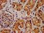 IHC image diluted at 1:200 and staining in paraffin-embedded human kidney tissue performed on a Leica BondTM system. After dewaxing and hydration, antigen retrieval was mediated by high pressure in a citrate buffer (pH 6.0). Section was blocked with 10% normal goat serum 30min at RT. Then primary antibody (1% BSA) was incubated at 4°C overnight. The primary is detected by a biotinylated secondary antibody and visualized using an HRP conjugated SP system.