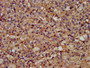 IHC image diluted at 1:200 and staining in paraffin-embedded human adrenal gland tissue performed on a Leica BondTM system. After dewaxing and hydration, antigen retrieval was mediated by high pressure in a citrate buffer (pH 6.0). Section was blocked with 10% normal goat serum 30min at RT. Then primary antibody (1% BSA) was incubated at 4°C overnight. The primary is detected by a biotinylated secondary antibody and visualized using an HRP conjugated SP system.