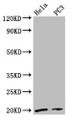 Western Blot; Positive WB detected in: Hela whole cell lysate, PC-3 whole cell lysate; All lanes: NDUFAF2 antibody at 2.7µg/ml; Secondary; Goat polyclonal to rabbit IgG at 1/50000 dilution; Predicted band size: 20 kDa; Observed band size: 20 kDa