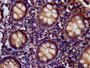 IHC image diluted at 1:400 and staining in paraffin-embedded human appendix tissue performed on a Leica BondTM system.