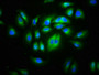 Immunofluorescence staining of A549 cells with CAC11341 at 1:133, counter-stained with DAPI. The cells were fixed in 4% formaldehyde, permeabilized using 0.2% Triton X-100 and blocked in 10% normal Goat Serum. The cells were then incubated with the antibody overnight at 4°C. The secondary antibody was Alexa Fluor 488-congugated AffiniPure Goat Anti-Rabbit IgG(H+L).