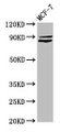 Western Blot; Positive WB detected in: MCF-7 whole cell lysate; All lanes: MED15 antibody at 5.2µg/ml; Secondary; Goat polyclonal to rabbit IgG at 1/50000 dilution; Predicted band size: 87, 83, 76 kDa; Observed band size: 87 kDa