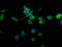 Immunofluorescence staining of SH-SY5Y cells with CAC11342 at 1:100, counter-stained with DAPI. The cells were fixed in 4% formaldehyde, permeabilized using 0.2% Triton X-100 and blocked in 10% normal Goat Serum. The cells were then incubated with the antibody overnight at 4°C. The secondary antibody was Alexa Fluor 488-congugated AffiniPure Goat Anti-Rabbit IgG(H+L).
