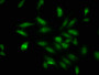 Immunofluorescence staining of Hela cells with CAC11343 at 1:100, counter-stained with DAPI. The cells were fixed in 4% formaldehyde, permeabilized using 0.2% Triton X-100 and blocked in 10% normal Goat Serum. The cells were then incubated with the antibody overnight at 4°C. The secondary antibody was Alexa Fluor 488-congugated AffiniPure Goat Anti-Rabbit IgG(H+L).