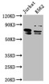 Western Blot; Positive WB detected in: Jurkat whole cell lysate, K562 whole cell lysate; All lanes: THEMIS antibody at 7.6µg/ml; Secondary; Goat polyclonal to rabbit IgG at 1/50000 dilution; Predicted band size: 74, 70, 63, 78 kDa; Observed band size: 74, 70 kDa