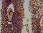 IHC image diluted at 1:300 and staining in paraffin-embedded human spleen tissue performed on a Leica BondTM system. After dewaxing and hydration, antigen retrieval was mediated by high pressure in a citrate buffer (pH 6.0). Section was blocked with 10% normal goat serum 30min at RT. Then primary antibody (1% BSA) was incubated at 4°C overnight. The primary is detected by a biotinylated secondary antibody and visualized using an HRP conjugated SP system.