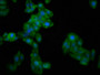 Immunofluorescence staining of HepG2 cells with CAC11347 at 1:266, counter-stained with DAPI. The cells were fixed in 4% formaldehyde, permeabilized using 0.2% Triton X-100 and blocked in 10% normal Goat Serum. The cells were then incubated with the antibody overnight at 4°C. The secondary antibody was Alexa Fluor 488-congugated AffiniPure Goat Anti-Rabbit IgG(H+L). Immunofluorescence staining of HepG2 cells with CAC11347 at 1:266, counter-stained with DAPI. The cells were fixed in 4% formaldehyde, permeabilized using 0.2% Triton X-100 and blocked in 10% normal Goat Serum. The cells were then incubated with the antibody overnight at 4°C. The secondary antibody was Alexa Fluor 488-congugated AffiniPure Goat Anti-Rabbit IgG(H+L).
