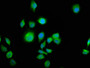 Immunofluorescence staining of A549 cells with CAC11348 at 1:100, counter-stained with DAPI. The cells were fixed in 4% formaldehyde, permeabilized using 0.2% Triton X-100 and blocked in 10% normal Goat Serum. The cells were then incubated with the antibody overnight at 4°C. The secondary antibody was Alexa Fluor 488-congugated AffiniPure Goat Anti-Rabbit IgG(H+L).