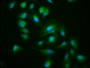 Immunofluorescence staining of Hela cells with CAC11355 at 1:200, counter-stained with DAPI. The cells were fixed in 4% formaldehyde, permeabilized using 0.2% Triton X-100 and blocked in 10% normal Goat Serum. The cells were then incubated with the antibody overnight at 4°C. The secondary antibody was Alexa Fluor 488-congugated AffiniPure Goat Anti-Rabbit IgG(H+L).