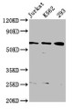Western Blot; Positive WB detected in: Jurkat whole cell lysate, K562 whole cell lysate, 293 whole cell lysate; All lanes: ELP3 antibody at 3.82µg/ml; Secondary; Goat polyclonal to rabbit IgG at 1/50000 dilution; Predicted band size: 63, 61, 50, 53 kDa; Observed band size: 63 kDa