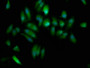 Immunofluorescence staining of Hela cells with CAC11360 at 1:133, counter-stained with DAPI. The cells were fixed in 4% formaldehyde, permeabilized using 0.2% Triton X-100 and blocked in 10% normal Goat Serum. The cells were then incubated with the antibody overnight at 4°C. The secondary antibody was Alexa Fluor 488-congugated AffiniPure Goat Anti-Rabbit IgG(H+L).