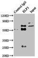Immunoprecipitating ELP3 in HEK293 whole cell lysate; , Lane 1: Rabbit control IgG instead in HEK293 whole cell lysate. For western blotting, a HRP-conjugated Protein G antibody was used as the secondary antibody (1/2000); , Lane 2: CAC11360 (6µg) + HEK293 whole cell lysate (500µg); , Lane 3: HEK293 whole cell lysate (20µg)