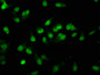 Immunofluorescence staining of Hela cells with CAC11363 at 1:167, counter-stained with DAPI. The cells were fixed in 4% formaldehyde, permeabilized using 0.2% Triton X-100 and blocked in 10% normal Goat Serum. The cells were then incubated with the antibody overnight at 4°C. The secondary antibody was Alexa Fluor 488-congugated AffiniPure Goat Anti-Rabbit IgG(H+L).