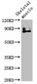 Western Blot; Positive WB detected in: Mouse skeletal muscle tissue; All lanes: TRPV2 antibody at 4.51µg/ml; Secondary; Goat polyclonal to rabbit IgG at 1/50000 dilution; Predicted band size: 86 kDa; Observed band size: 86 kDa;