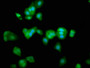 Immunofluorescence staining of HepG2 cells with CAC11366 at 1:266, counter-stained with DAPI. The cells were fixed in 4% formaldehyde, permeabilized using 0.2% Triton X-100 and blocked in 10% normal Goat Serum. The cells were then incubated with the antibody overnight at 4°C. The secondary antibody was Alexa Fluor 488-congugated AffiniPure Goat Anti-Rabbit IgG(H+L).