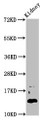 Western Blot; Positive WB detected in: Mouse kidney tissue; All lanes: DPPA5 antibody at 4.6µg/ml; Secondary; Goat polyclonal to rabbit IgG at 1/50000 dilution; Predicted band size: 14 kDa; Observed band size: 14 kDa;