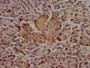 IHC image diluted at 1:400 and staining in paraffin-embedded human pancreatic tissue performed on a Leica BondTM system. After dewaxing and hydration, antigen retrieval was mediated by high pressure in a citrate buffer (pH 6.0). Section was blocked with 10% normal goat serum 30min at RT. Then primary antibody (1% BSA) was incubated at 4°C overnight. The primary is detected by a biotinylated secondary antibody and visualized using an HRP conjugated SP system.