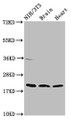 Western Blot; Positive WB detected in: NIH/3T3 whole cell lysate, Rat brain tissue, Mouse heart tissue; All lanes: NDUFB8 antibody at 2µg/ml; Secondary; Goat polyclonal to rabbit IgG at 1/50000 dilution; Predicted band size: 22, 21, 19 kDa; Observed band size: 22 kDa;