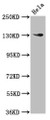Western Blot; Positive WB detected in: Hela whole cell lysate; All lanes: NOMO1 antibody at 3µg/ml; Secondary; Goat polyclonal to rabbit IgG at 1/50000 dilution; Predicted band size: 135 kDa; Observed band size: 135 kDa