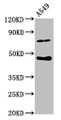 Western Blot; Positive WB detected in: A549 whole cell lysate; All lanes: SPOPL antibody at 6.3µg/ml; Secondary; Goat polyclonal to rabbit IgG at 1/50000 dilution; Predicted band size: 45 kDa; Observed band size: 45 kDa