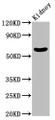 Western Blot; Positive WB detected in: Mouse kidney tissue; All lanes: MGAT3 antibody at 2.35µg/ml; Secondary; Goat polyclonal to rabbit IgG at 1/50000 dilution; Predicted band size: 62 kDa; Observed band size: 62 kDa;