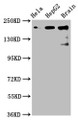 Western Blot; Positive WB detected in: Hela whole cell lysate, HepG2 whole cell lysate, Rat brain tissue; All lanes: CKAP5 antibody at 6µg/ml; Secondary; Goat polyclonal to rabbit IgG at 1/50000 dilution; Predicted band size: 226, 219, 227 kDa; Observed band size: 226 kDa